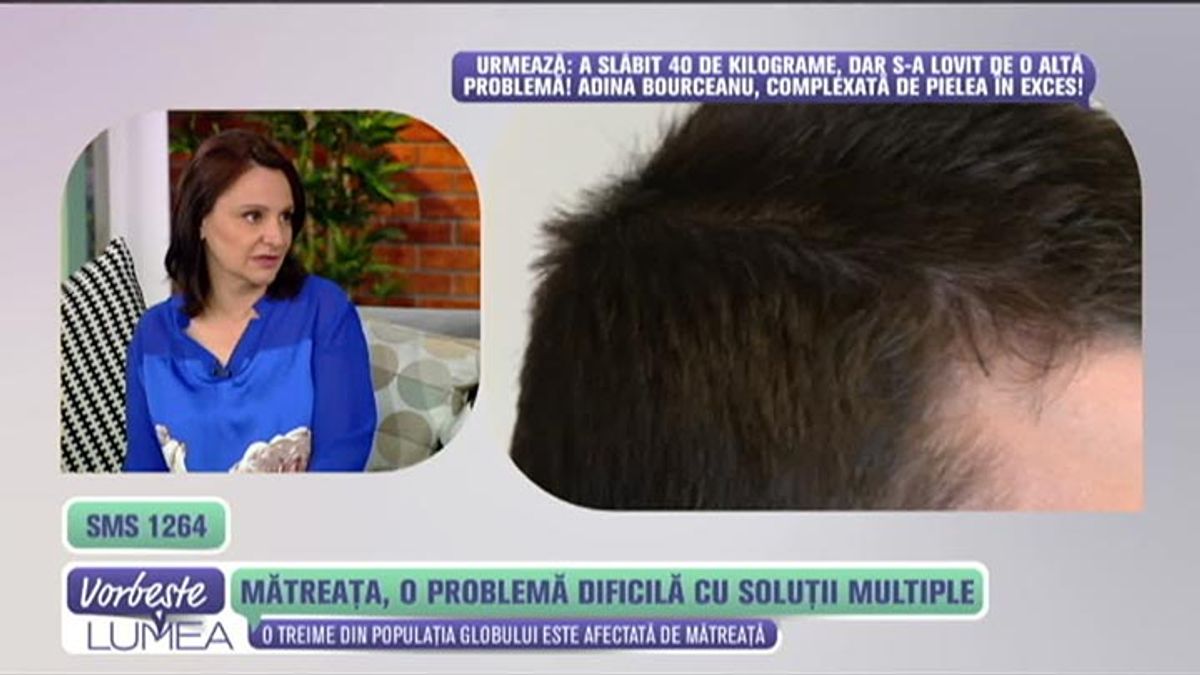 Matreata O Problema Dificila Cu Solutii Multiple Scene Si Bonusuri