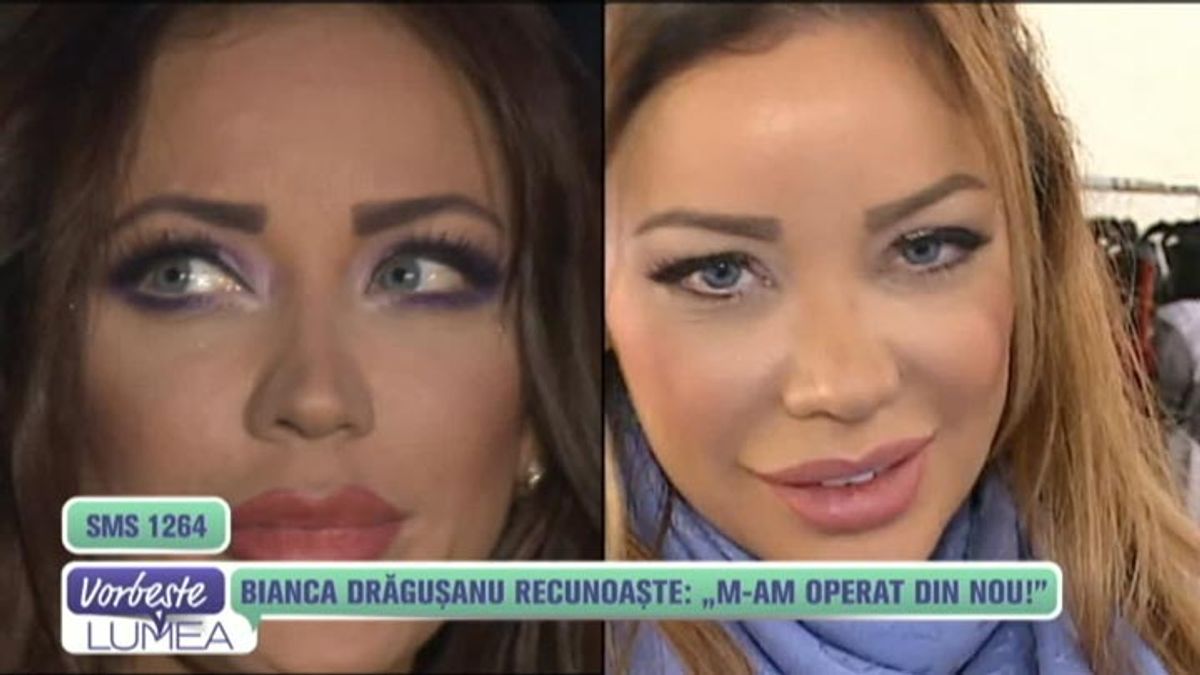 Bianca Dragusanu Recunoaste M Am Operat Din Nou Scene Si Bonusuri