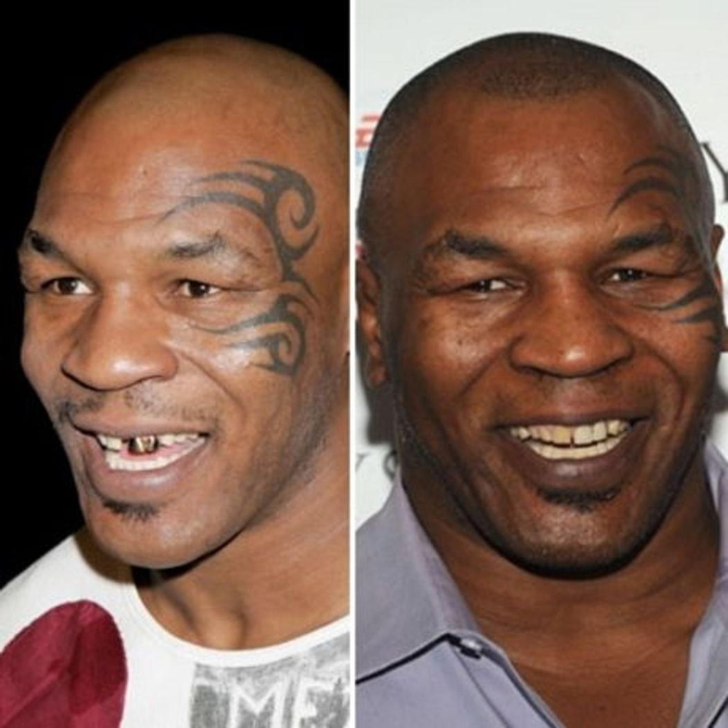 Mike Tyson
