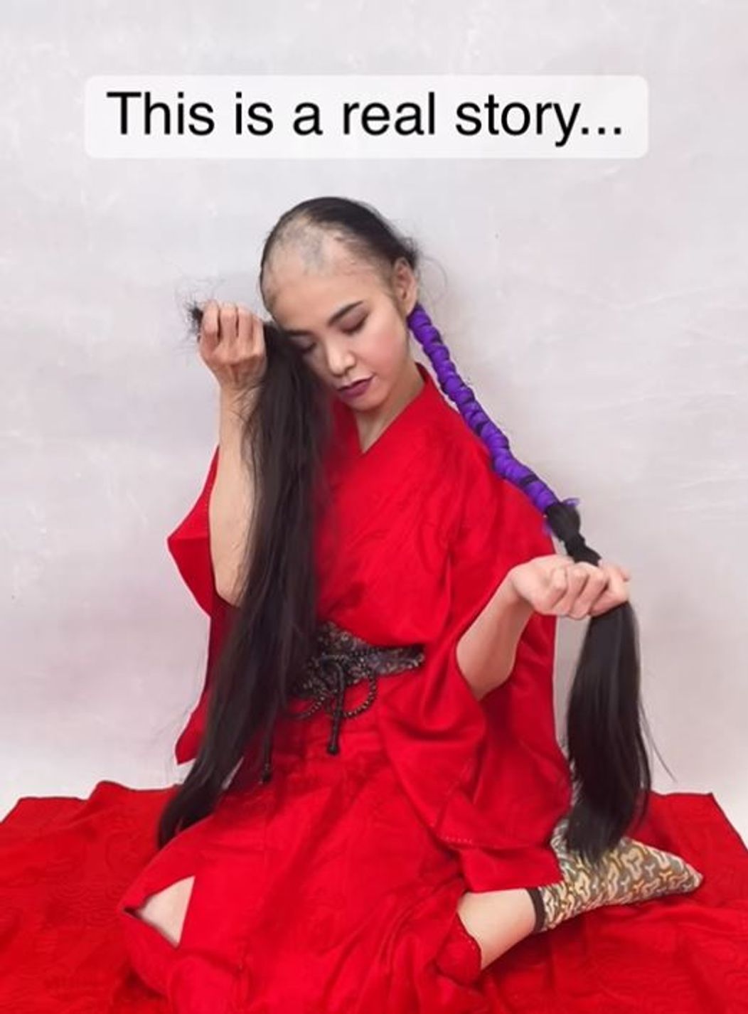 alopecie-fata-japonia