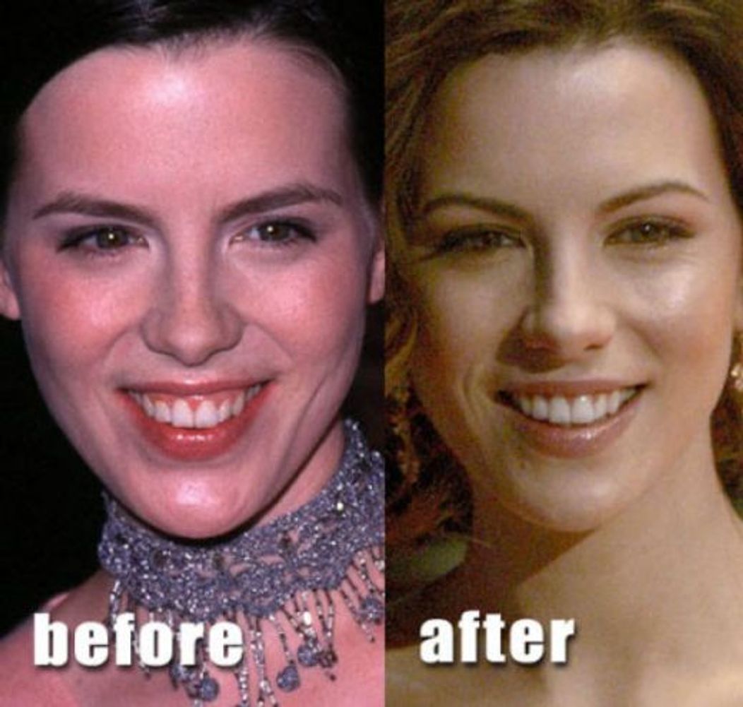 Kate Beckinsale