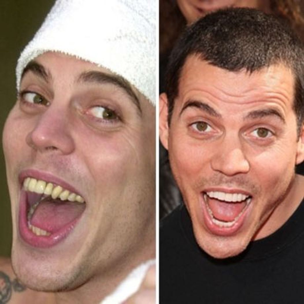 Steve-O