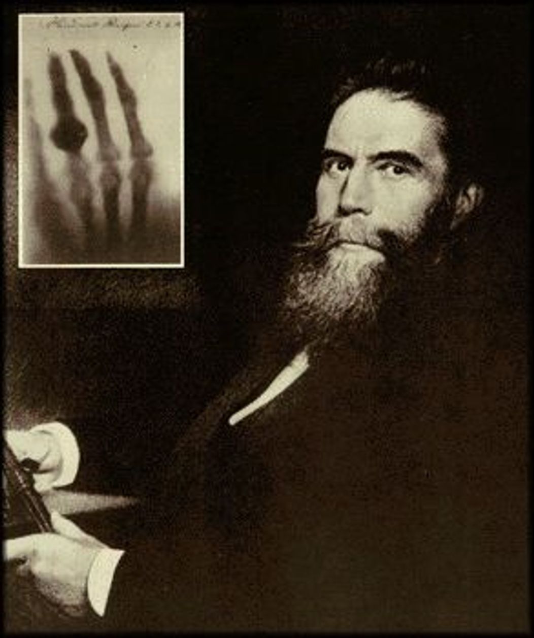 Wilhelm Rontgen