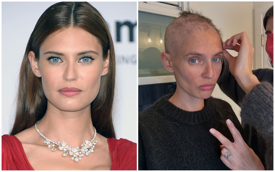 bianca -model-cancer