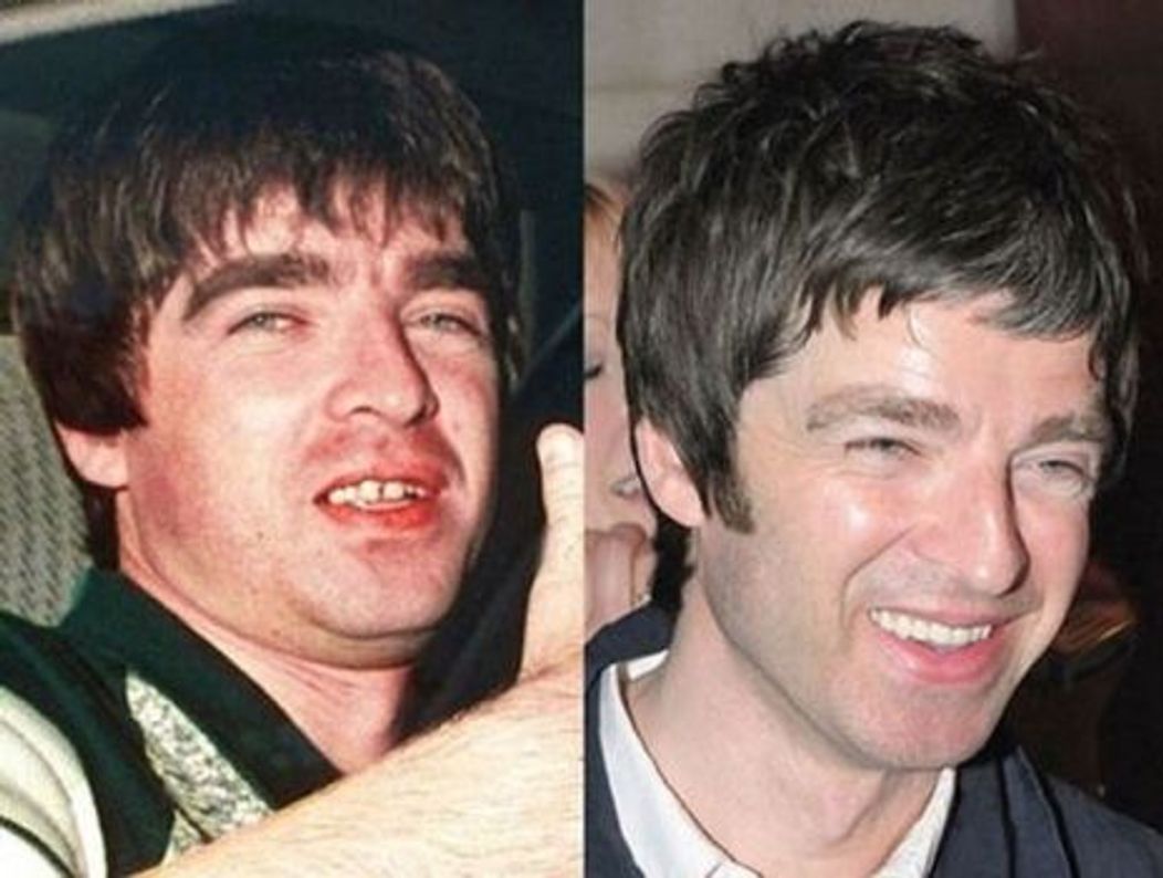Noel Gallagher