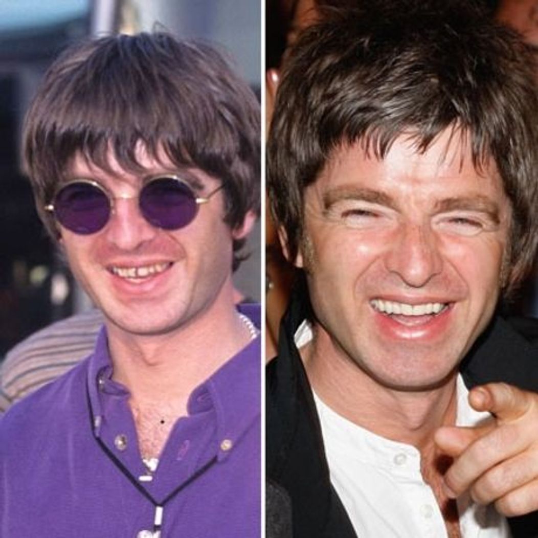 Noel Gallagher