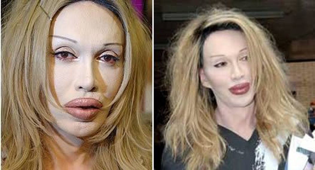 Pete Burns