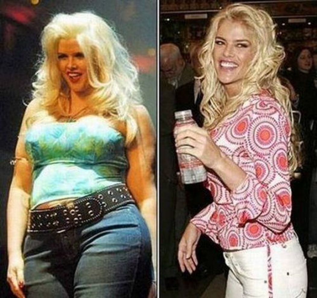 Anna Nicole Smith