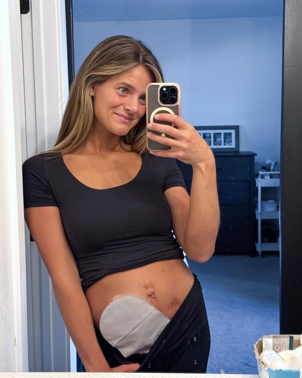 Happy 5 year anniversary to my Ostomy!🧁Beyond grateful to be alive today and not just alive but