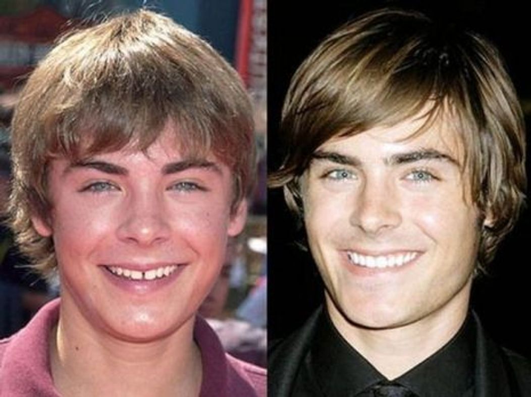 Zac Efron