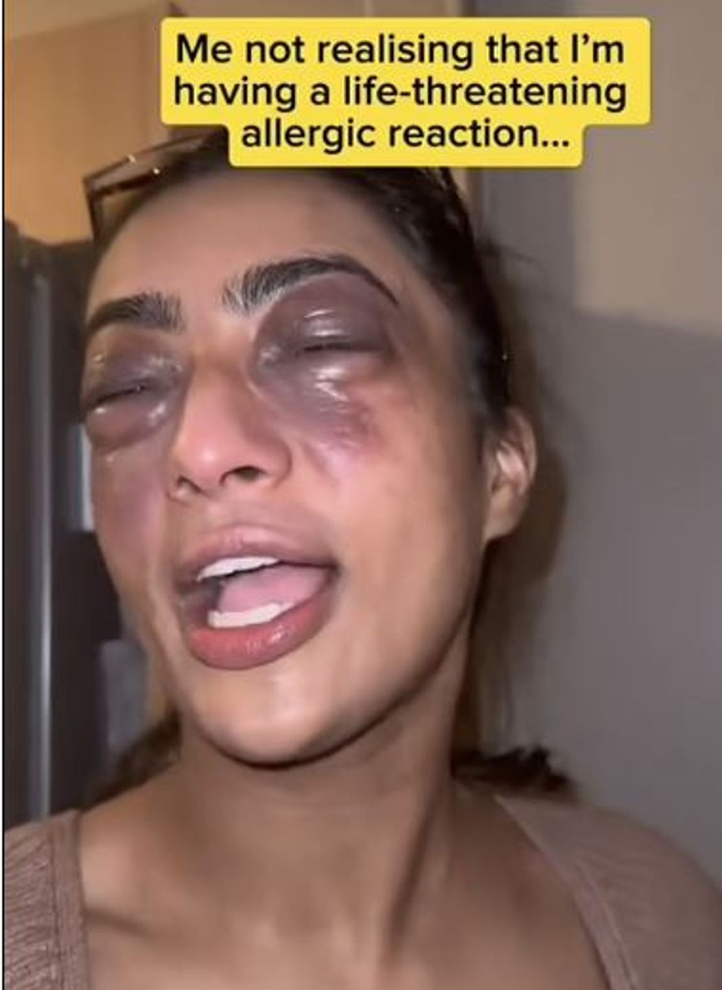 Reactie alergica