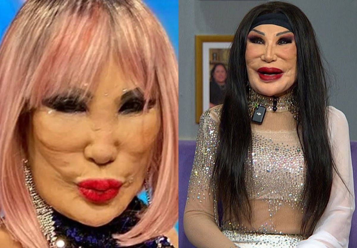 Recunoști celebra actriță? Operațiile estetice i-au mutilat fața și ...