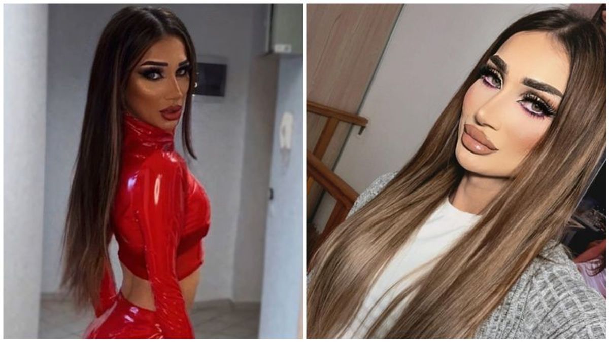 Amarah a apelat la o nouă intervenție estetică. Cum arată acum cea mai ...