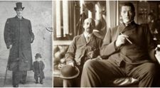 S-a nascut pitic, dar a decedat un urias. Cazul incredibil al barbatului care a suferit si de nanism si de gigantism