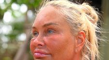 Ce s-a întâmplat cu fața Vicăi Blochina la Survivor România: „Aveam bube peste tot”
