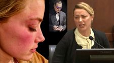 Amber Heard a arătat judecătorului vânătăile pe care i le-ar fi făcut Johnny Depp în trecut