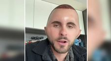 Ce i s-a întâmplat unui tânăr de 27 de ani după un transplant de păr pentru care a plătit 17.500 $: „Arătam fix ca un ou!”