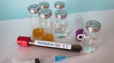 Ce simptome provoacă hantavirus, virusul potențial mortal care s-a răspândit acum pe o croazieră în Atlantic și care a ucis-o pe soția lui Gene Hackman