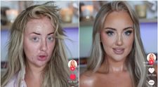 Transformare șocantă: de la acnee și imperfecțiuni la diva absolută.  