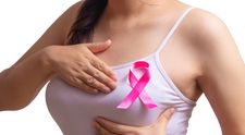 (P) Cancerul la sân: cauze, simptome, diagnostic, opțiuni de tratament