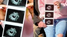 Influencerița și soțul ei au decis să întrerupă sarcina după ce au aflat că fătul are sindromul Down. Sunt amenințați cu moartea și dorm cu un pistol lângă pat: „Nu mi-am dat seama cât de greu este pentru copil”