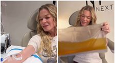 LeAnn Rimes, tratament extrem de „curățare a sângelui” de 45.000 de dolari, după ce i-au căzut dinții pe scenă