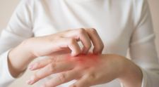 (P) Mâncărimea de piele reală vs. mâncărimile psihogene - Află care sunt diferențele