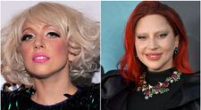 Lady Gaga, cu fizionomia schimbată radical. Vedeta arată diferit, iar chirurgii esteticieni și-au dat seama ce operații și-a făcut