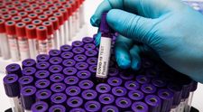 În ce condiții se vor putea testa pentru noul coronavirus bucureștenii care pleacă în Grecia și în alte vacanțe?