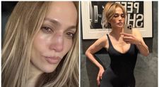 Imagini șocante cu Jennifer Lopez rănită pe față. Ce a declarat artista