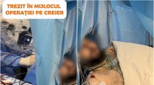 Este momentul care a uimit internetul! Un bărbat s-a trezit în mijlocul operației pe creier și a început să cânte: „E conștient?”