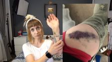 Bianca Adam, alias Tequila, bătută în parcare de un dezvoltator imobiliar. Ce chin a îndurat