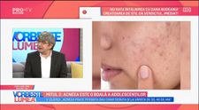 VIDEO Cum apare acneea și cum scăpăm de ea