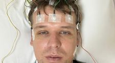 Bărbatul care nu a mai dormit timp de doi ani. Cazul rar care a uimit medicii: 