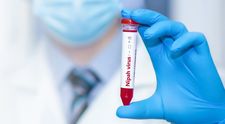 Cum se transmite virusul Nipah și cât de periculos este. Kazahstanul intensifică controlul la frontiere, după ce primele cazuri de infectare s-au înregistrat în India