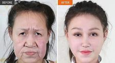 La 15 ani arăta ca la 60. Transformarea uluitoare a adolescentei chineze după ce a fost operată de 10 medici
