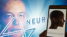 Mii de persoane, interesate să-și îndepărteze o bucată de craniu și să-și implanteze în creier chip-urile lui Elon Musk