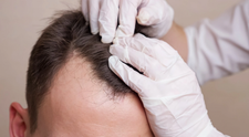 (P) Bucharest Hair Institute te ajută să redobândești părul bogat