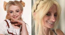 Cum arată la 48 de ani o femeie diagnosticată cu progeria. Medicii îi dădeau doar 12 ani de viață