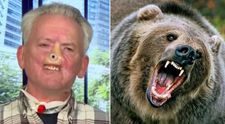 Si-a pierdut nasul dupa o lupta cu un urs Grizzly, iar acum il tine in viata pe brat