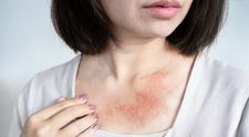 O femeie a crezut că este alergică la materialul rochiei, dar testele au arătat altceva. Substanța ascunsă care i-a provocat iritații pe tot corpul