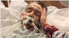 Bărbatul care a intrat în comă după ce a încercat să scoată un fir de păr crescut sub piele s-a recuperat. Familia vorbește despre un miracol