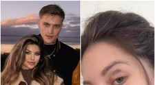 Valerie Lungu a apărut cu ochiul vânăt pe internet. Celebra influenceriță a povestit ce a pățit, iar fanii au avut un șoc. Ce s-a întâmplat