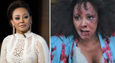 Mel B, desfigurată și plină de vânătăi într-un clip de promovare a luptei împotriva violenței domestice