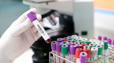 Noi descoperiri despre coronavirus. Ce probleme produce la nivelul sistemului nervos