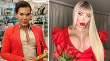 Bărbatul Ken, în costum de baie după ce a devenit Păpușa Barbie! Și-a arătat implantul fesier de 32.000 de euro