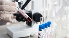 De ce ies unele teste de coronavirus fals pozitive. Explicația incredibilă a autorităților