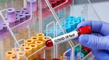 Un epidemiolog de top al OMS a vorbit în mod oficial despre rata deceselor cauzate până acum de noul coronavirus