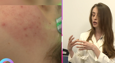 Totul despre tratamentul facial cu celule stem. Ce spune un consilier în estetică