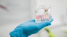 (P) Implanturile dentare pot necesita și adiție de os! Iată ce presupune această tehnică medicală!